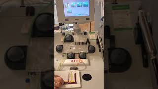 Apheresis part 3 Entering patient and procedure data [upl. by Iharas]