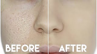 HOW TO HIDE ENLARGED PORES amp MAKE YOUR PORES DISAPPEAR [upl. by Bart]