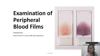 Examination of Peripheral Blood Smears [upl. by Ettenahs]