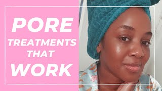 Treatment for Large Pores that WORK Black Skin [upl. by Tavis461]