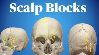 Scalp Blocks [upl. by Neira]