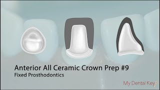 PASS THE CDCA  All Ceramic Anterior Crown Preparation  My Dental Key [upl. by Abehshtab]