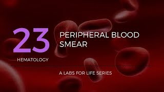 How to make Peripheral Blood Smears 3 ways [upl. by Aldrich]