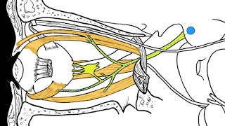 C6 Neurologic Weakness Post Nerve Root Decompression [upl. by Assilak]