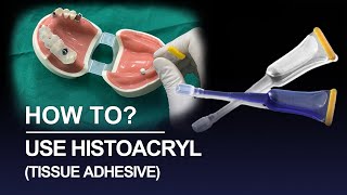 How to use histoacryl tissue adhesive [upl. by Ainaj]