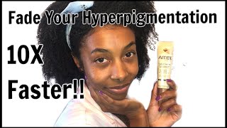 How To REALLY Use Ambi Fade Cream  Fade Hyperpigmentation [upl. by Law]