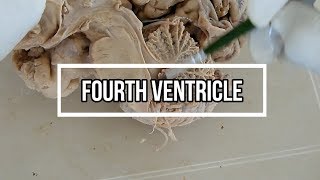 Fourth ventricle  neuroanatomy  floor  opening [upl. by Tomlinson103]