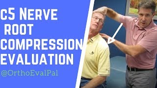 C5 Nerve Root Compression Evaluation [upl. by Nagiam]