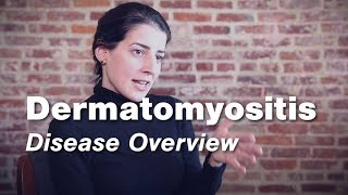 Dermatomyositis  Disease Overview  Johns Hopkins [upl. by Ahsinoj]