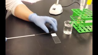 Bacterial smear preparation [upl. by Nurav98]