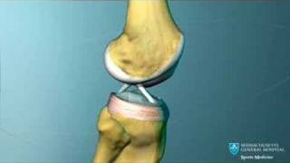 Knee Ligament Anatomy Animation [upl. by Zenger]