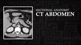 CT Cross Sectional Anatomy Abdomen Axial View [upl. by Aiset933]