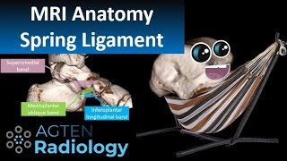 Spring Ligament Complex MRI Anatomy [upl. by Ebonee917]