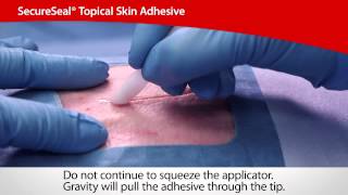 SecureSeal® Topical Skin Adhesive  Cardinal Health [upl. by Stronski612]