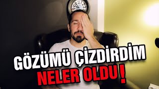 Göz Çizdirmeyi Düşünüyorsanız İzleyin İ  LASİK [upl. by Nace]