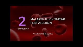 Malaria Thick Smear Preparation [upl. by Nylesor]