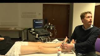 3D How To Ultrasound Guided Axillary Nerve Block  SonoSite Ultrasound [upl. by Aivax86]