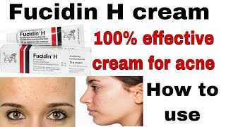 fucidin h cream uses in urdu For skin treatment of acne skin infectionsHow to use fusidin h cream [upl. by Gaylor47]