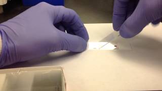 Hematology Making a Peripheral Blood Smear [upl. by Nosecyrb985]