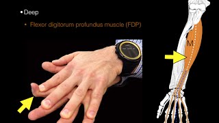 Forearm flexor muscles [upl. by Weinhardt]