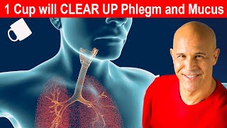 Top 5 Causes of Constant Mucus and Phlegm in Your Throat [upl. by Hamaso]