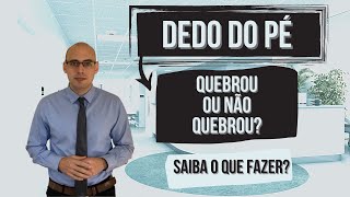 DEDO DO PÉ QUEBROU OU ACHA QUE QUEBROU ASSISTA [upl. by Tryck475]