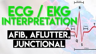 Afib Aflutter Junctional Arrhythmias  ECG EKG Interpretation Part 4 [upl. by Noived89]