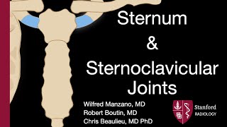 Sternum and Sternoclavicular Joints  Wilfred Manzano MD [upl. by Mcnelly]