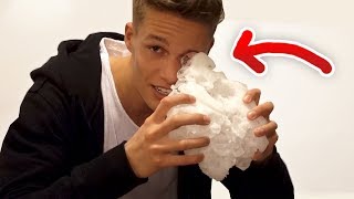 Ich habe mich verletzt 😱 Vlog [upl. by Atnohs]