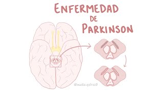 Enfermedad de Parkinson [upl. by Edelman]