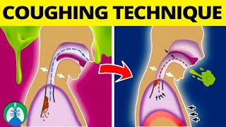 How To Get Rid of Mucus and Phlegm in Your Lungs [upl. by Bernat31]